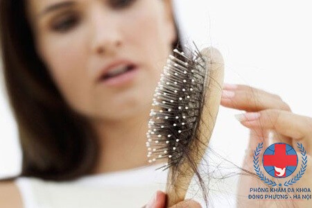 Rụng tóc nhiều ở phụ nữ phải làm sao?