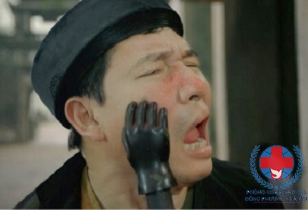 Các hiện tượng dị ứng nổi mề đay thường gặp