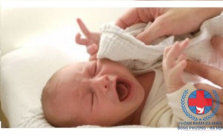 Mụn cơm ở trẻ sơ sinh có nguy hiểm không?