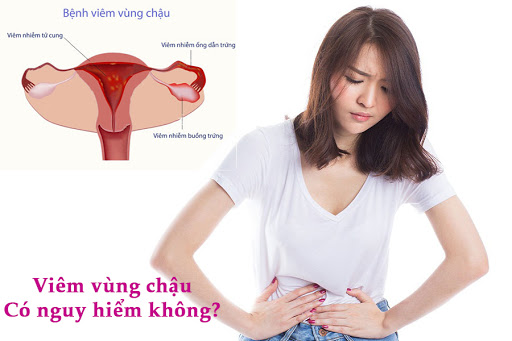 Viem Vung Chau Co Nguy Hiem Khong
