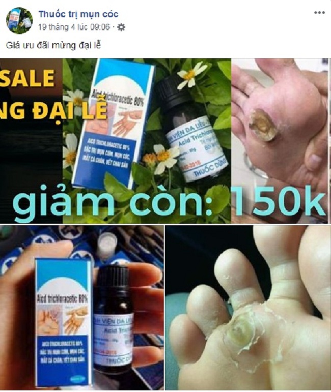 Canh Bao Nguy Hiem Tu Viec Dung Thuoc Tri Mun Com Acid Trichloracetic 80%