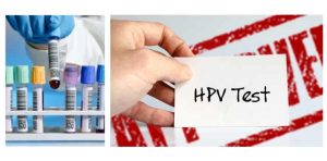 Đọc kết quả xét nghiệm HPV dương tính nói lên điều gì?