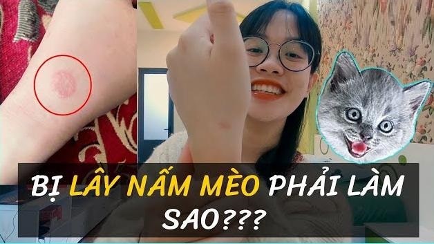 Bệnh nấm mèo ở người