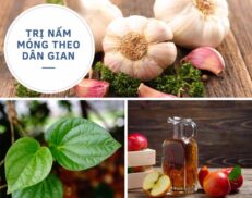 5 Mẹo dân gian chữa nấm móng tay + chân hiệu quả tại nhà