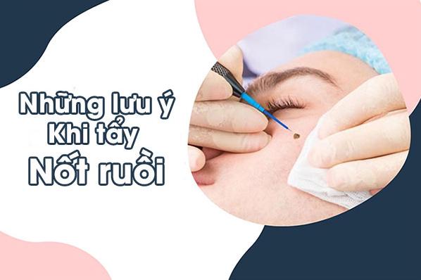 Những lưu ý khi tẩy nốt ruồi